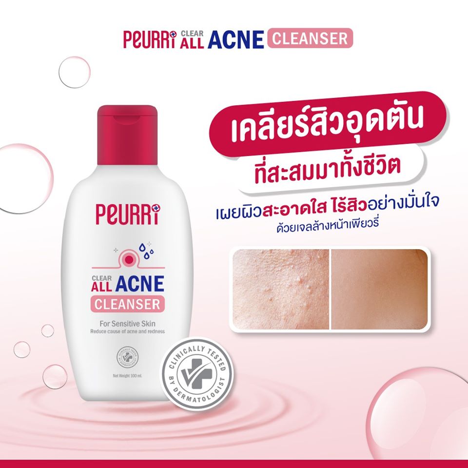 PEURRI, PEURRI รีวิว, PEURRI ราคา, Peurri All Acne รีวิว, PEURRI All Acne Clear Cleanser, PEURRI All Acne Clear Cleanser รีวิว, PEURRI All Acne Clear Cleanser ราคา, PEURRI All Acne Clear Cleanser 100ml, เจลล้างหน้า, เจลล้างหน้าลดสิว